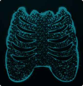 جراحی قفسه سینه - توراکس (Thorax)